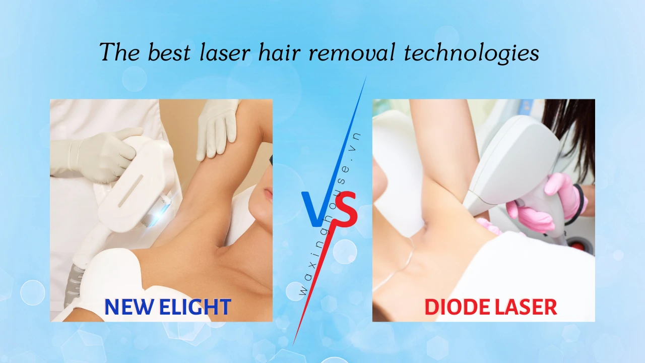 Diode laser and E-light: which one is better for hair removal?