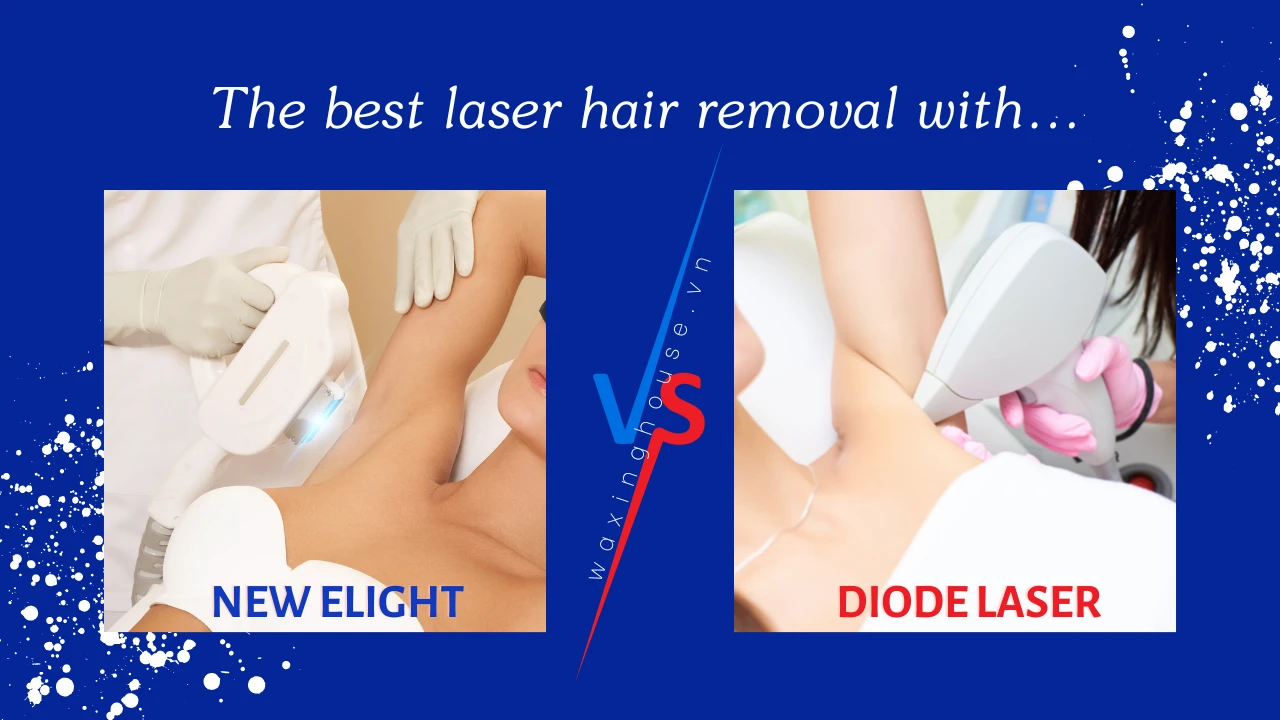 Effective laser hair removal service for men and women
