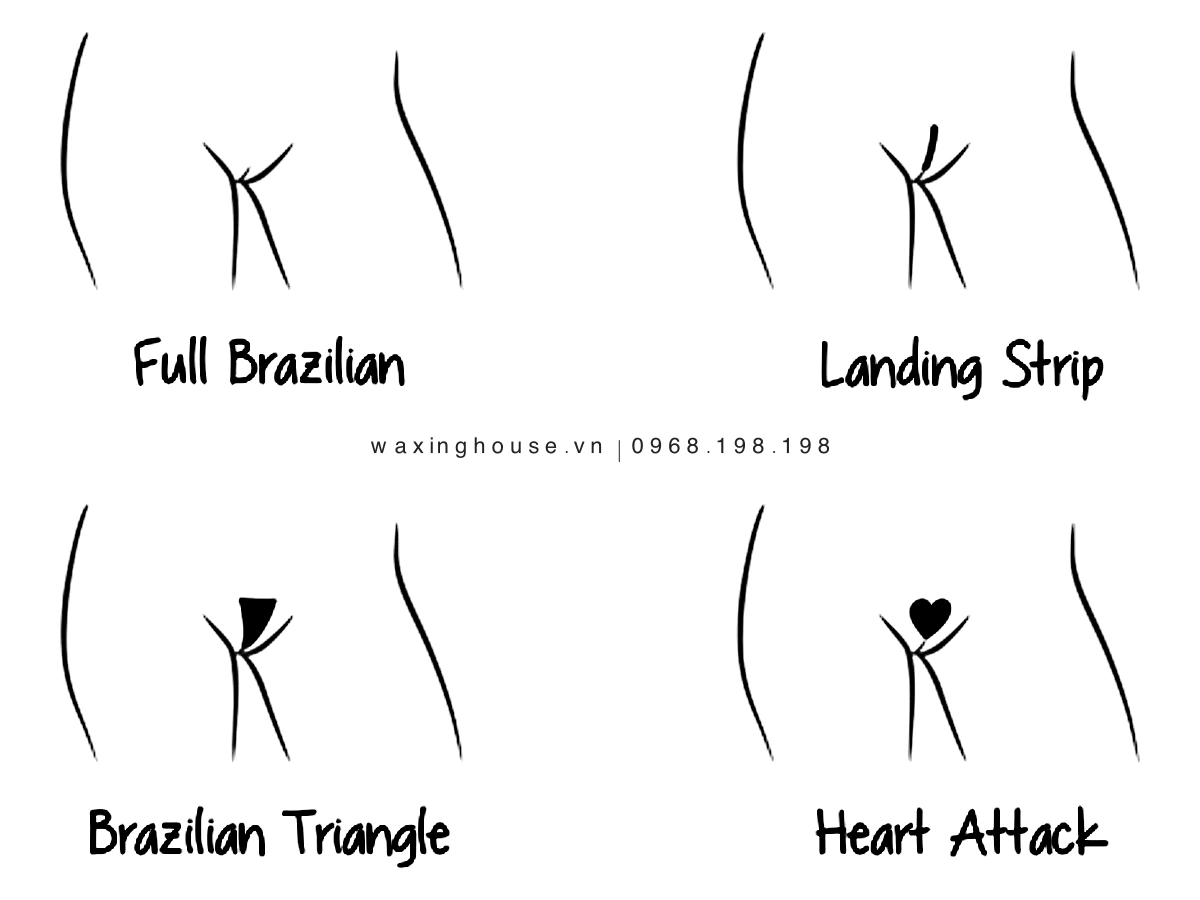 Landing strip vs triangle