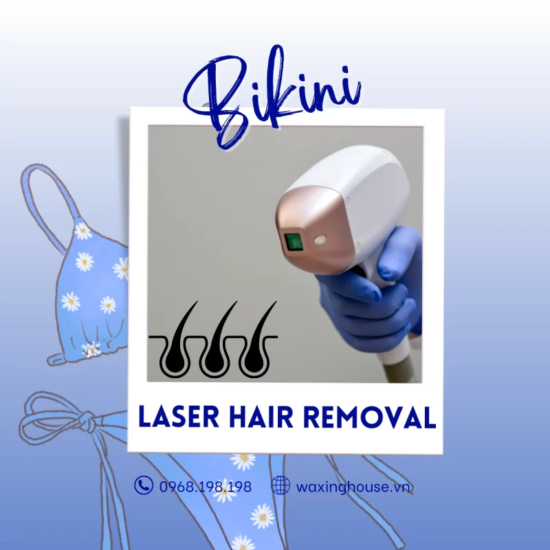 Bikini laser hair removal