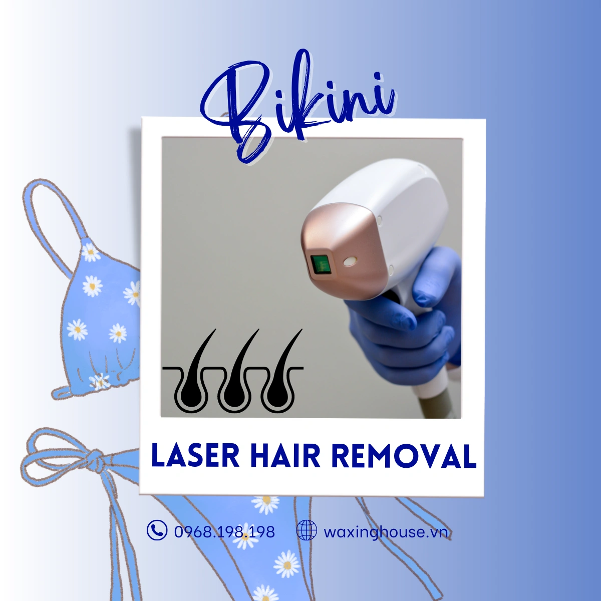 Bikini Waxing: A Comparison With Other Hair Removal Methods Bikini laser hair removal