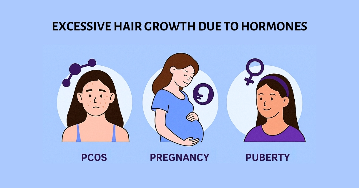 Excessive Hair Growth Due To Hormonal Changes: Waxing Or Laser Hair Removal? Comparing waxing and laser hair removal for hormonal hair growth