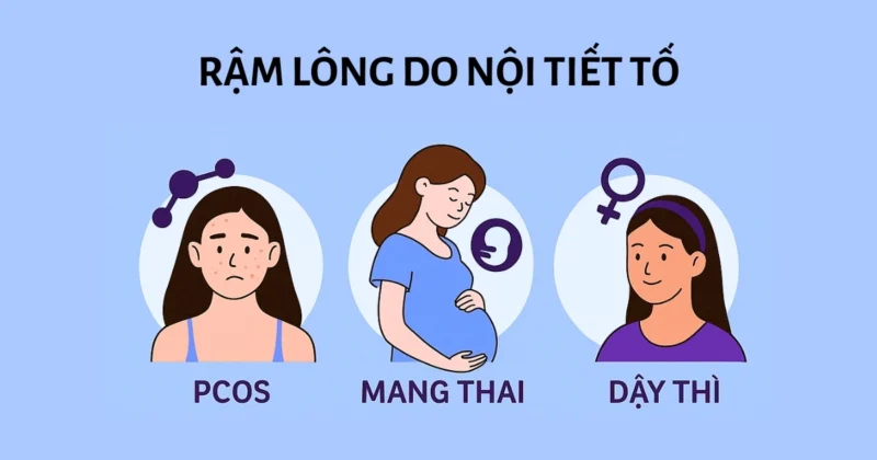 Giải pháp waxing và triệt lông an toàn cho tình trạng rậm lông do nội tiết tố